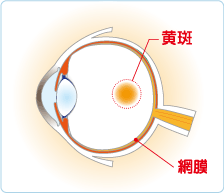 加齢黄斑変性図解